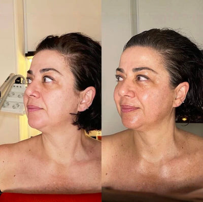 Lymphatic Drainage Drops