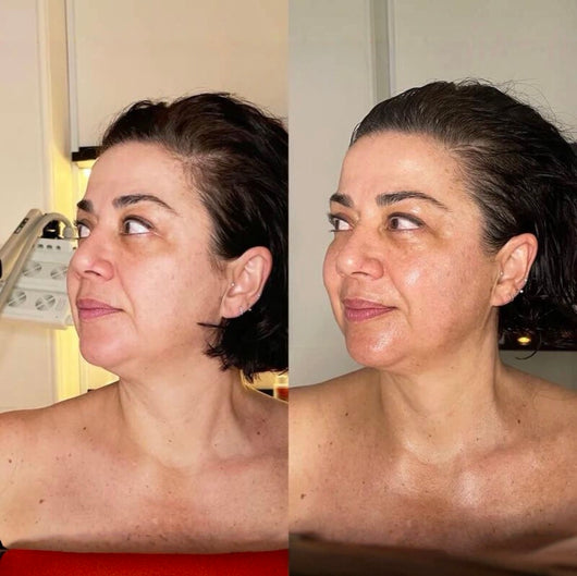 Lymphatic Drainage Drops