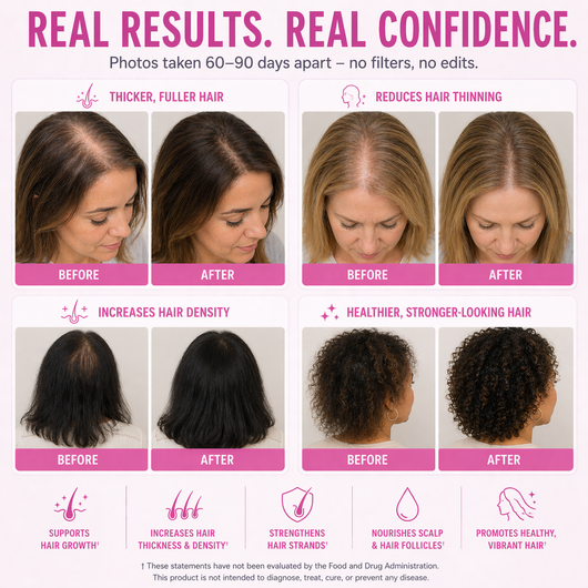Stop The Shedding & Regrow Thicker Fuller Hair